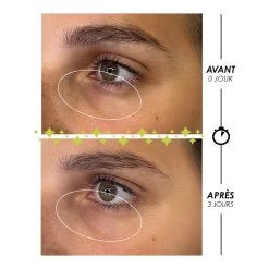 Dreamteam cosmétique. -Dreamteam cosmétique. Contour des yeux et paupiere anti cernes anti poches et anti rides 101827285 1