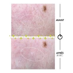 PSCHITT MAGIQUE NOUVELLE PEAU-Micropeeling Visage-GARANCIA 7 PSCHITT MAGIQUE NOUVELLE PEAU-Micropeeling Visage-GARANCIA -Dreamteam cosmétique. Micropeeling visage 101827357 1