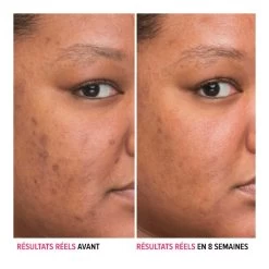 Bye Bye Darkspots-Sérum Anti-taches à La Niacinamide-IT COSMETICS -Dreamteam cosmétique. Serum anti taches a la niacinamide 102331450 2