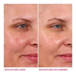 Hello Results Gommage Glycolique + Huiles De Soin-Votre Gommage Glycolique Effet Peau De Bébé Pour Un Usage Quotidien-IT COSMETICS 9 Hello Results Gommage Glycolique + Huiles De Soin-Votre Gommage Glycolique Effet Peau De Bébé Pour Un Usage Quotidien-IT COSMETICS -Dreamteam cosmétique. Votre gommage glycolique effet peau de bebe pour un usage quotidien 102332786 3